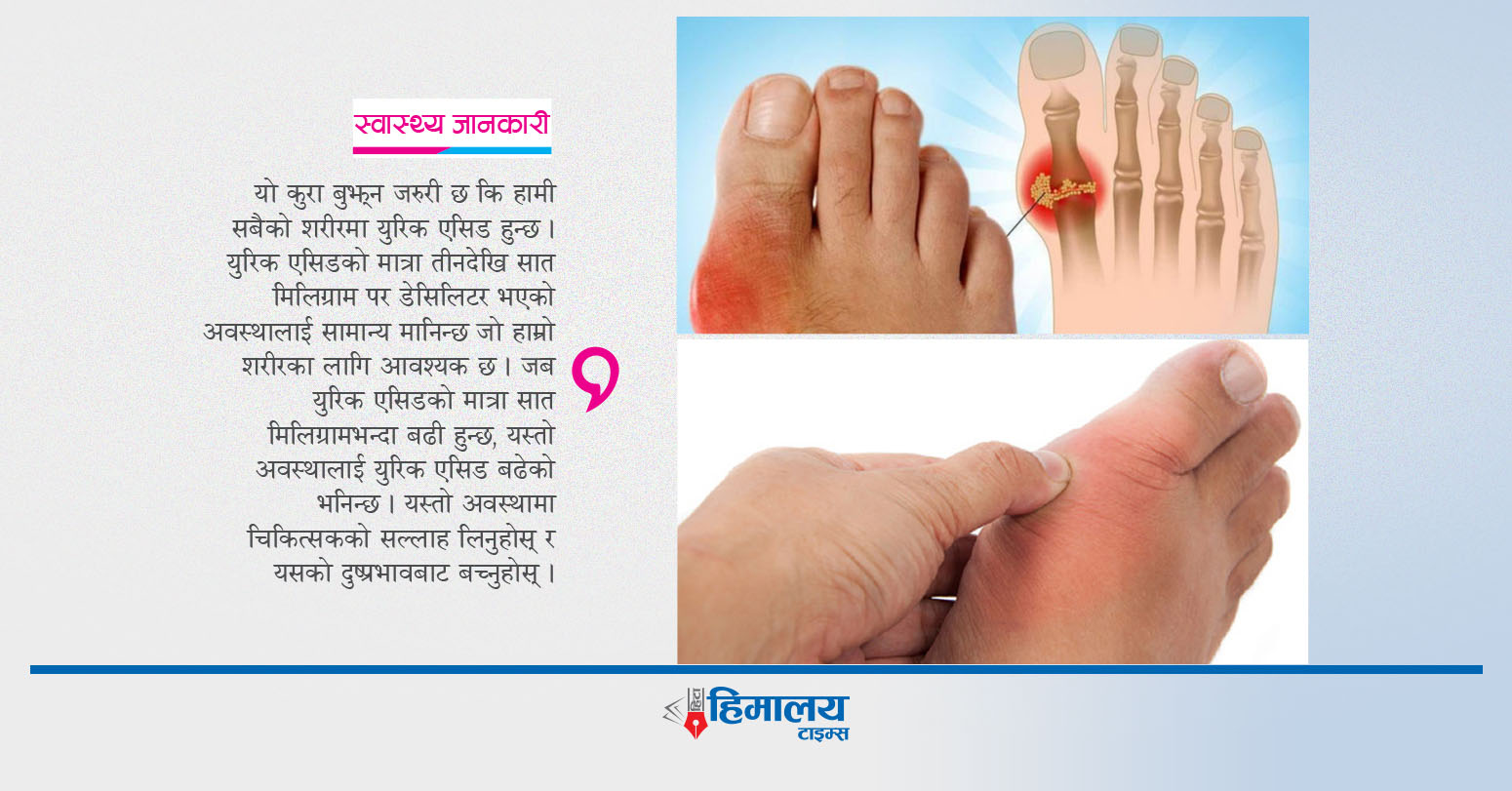 युरिक एसिड हुने कारण र बच्ने उपाय